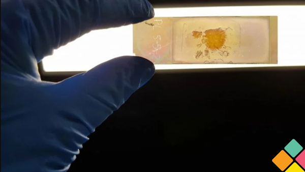 Instant cancer detection on a glass slide | 2024 Shaping Australia Awards finalists