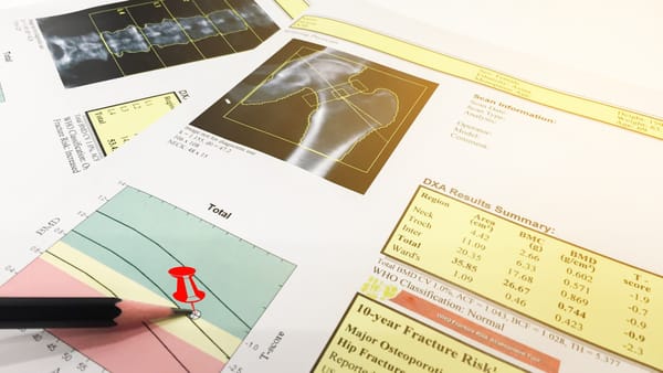 New machine algorithm could identify cardiovascular risk at the click of a button